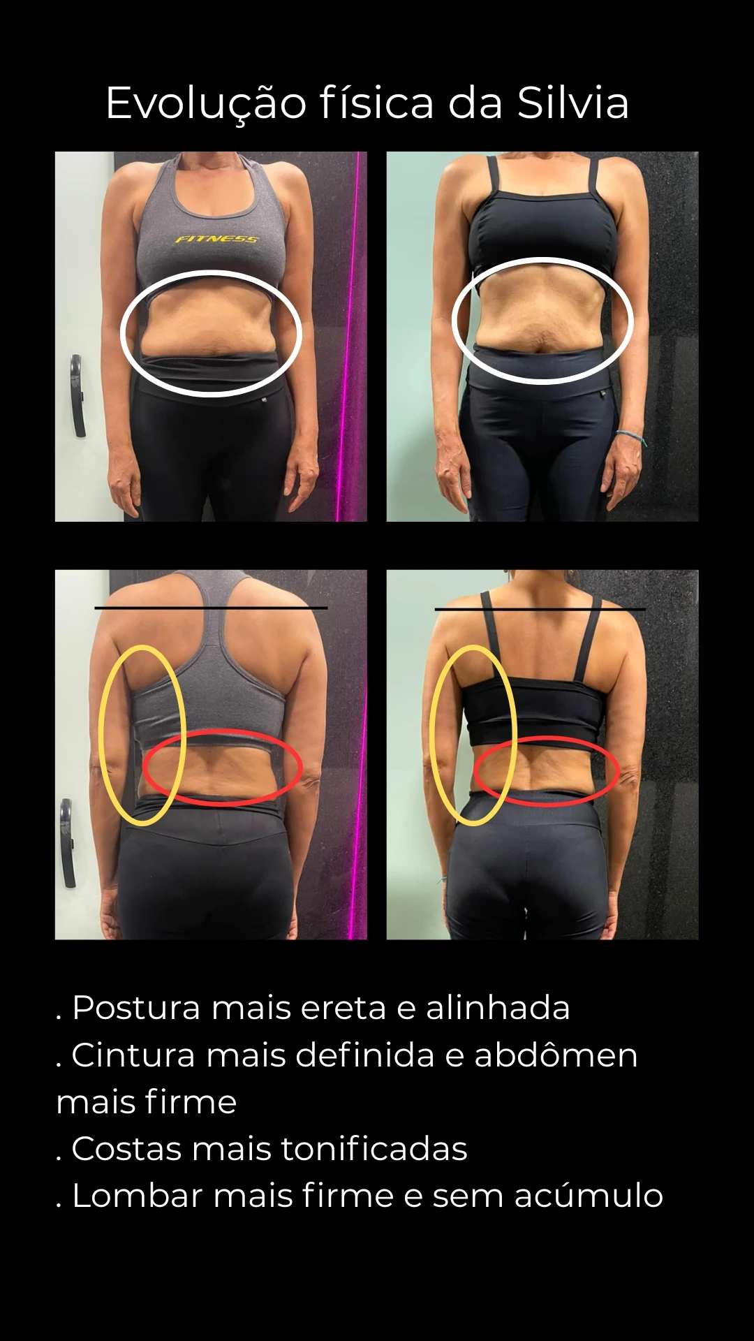 Comparativo antes e depois da aluna Silvia, com postura mais alinhada e cintura mais definida